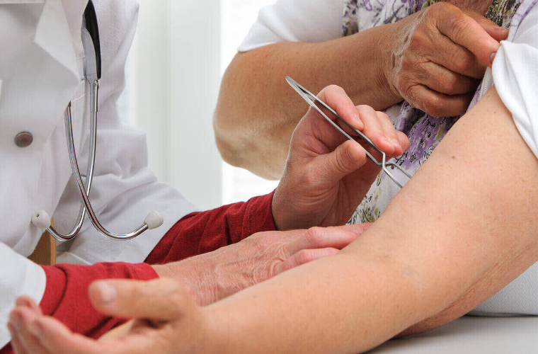 Borelioza - diagnostyka, postępowanie w praktyce lekarza POZ
