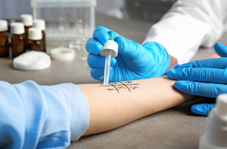 Alergia - Przyczyny, objawy i diagnostyka