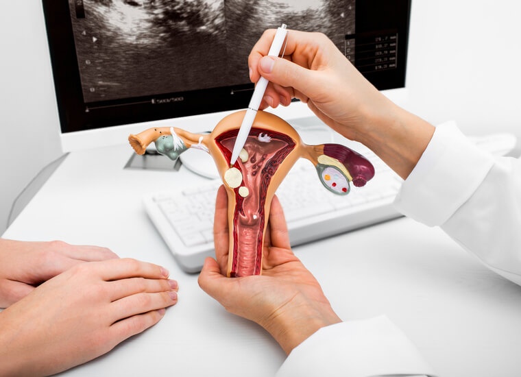 Cykl: Patologie endometrium. Wybrane, najważniejsze dane związane z diagnostyką i sposobem postępowania