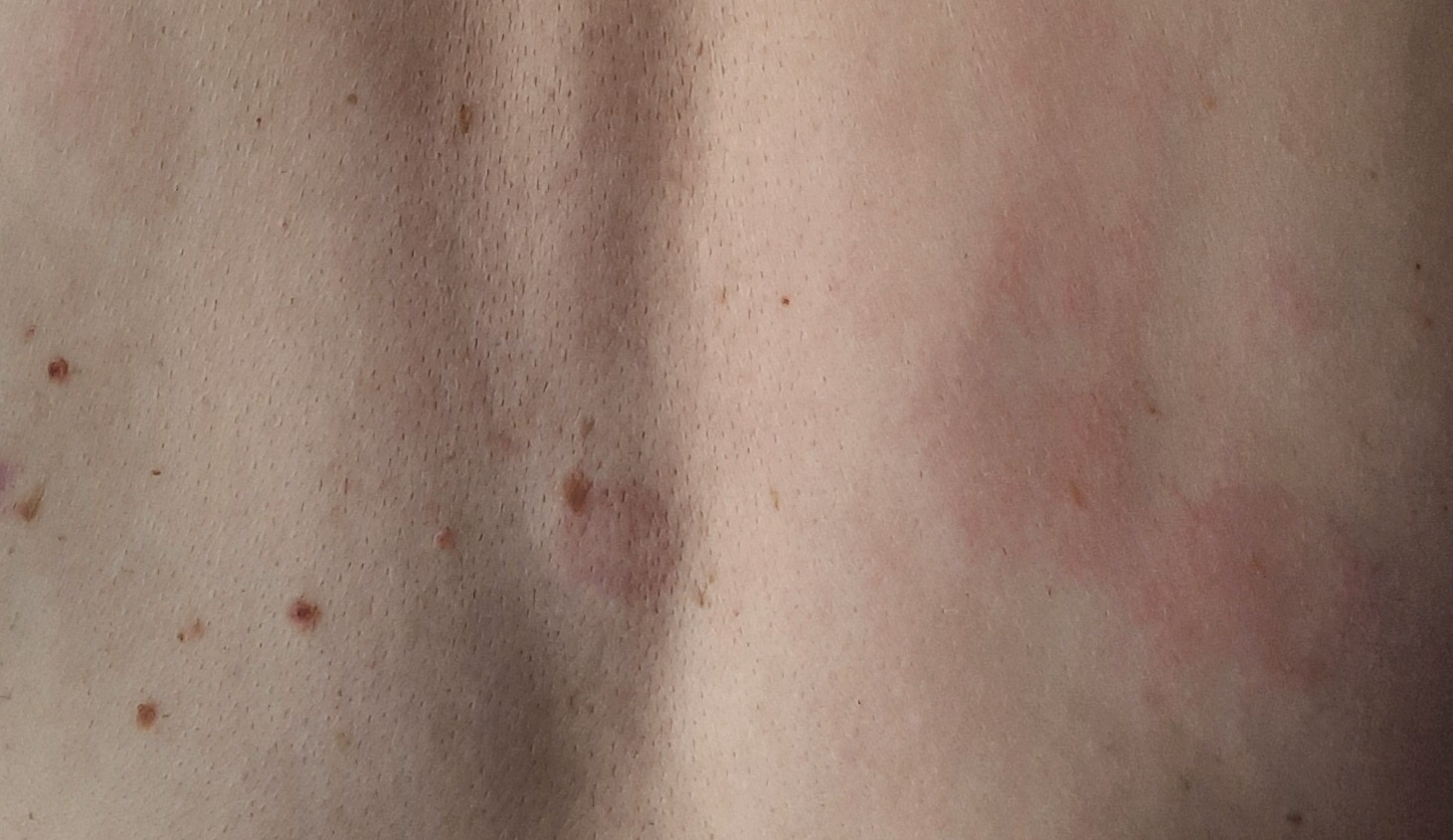 foto.4.1