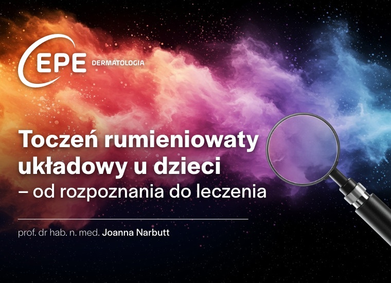 Toczeń rumieniowaty układowy u dzieci – od rozpoznania do leczenia