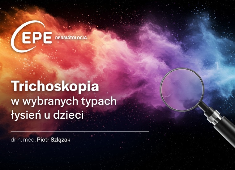 Trichoskopia w wybranych typach łysień u dzieci